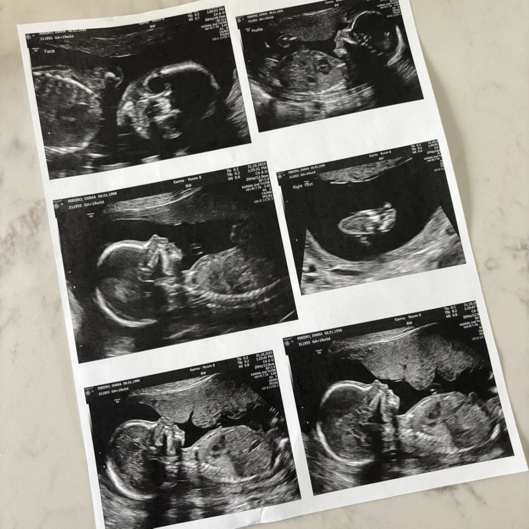 Photo shared by Emma for their Babylist baby registry.