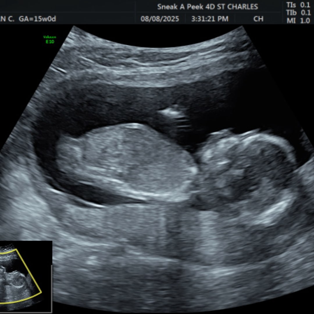 Photo shared by Jordan for their Babylist baby registry.