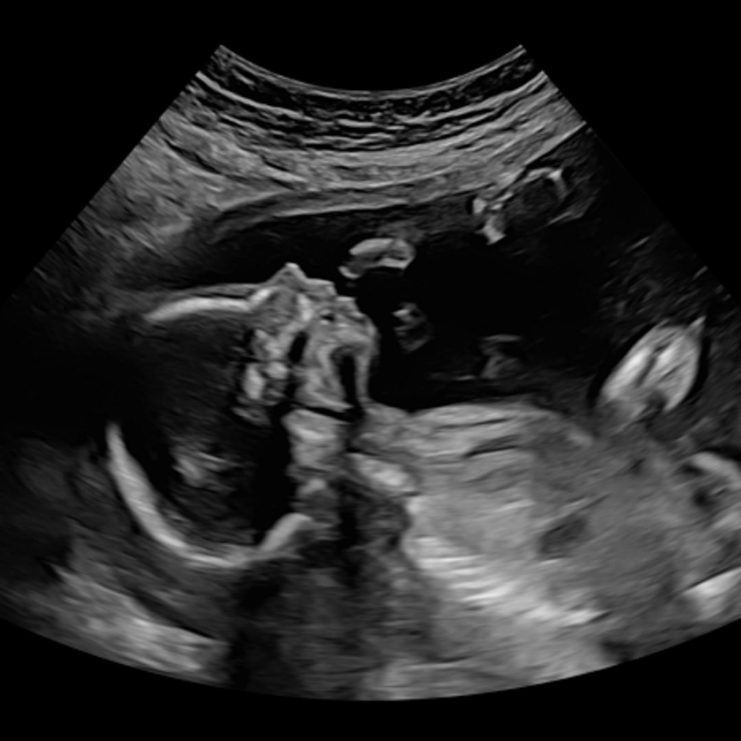 Photo shared by Carly for their Babylist baby registry.