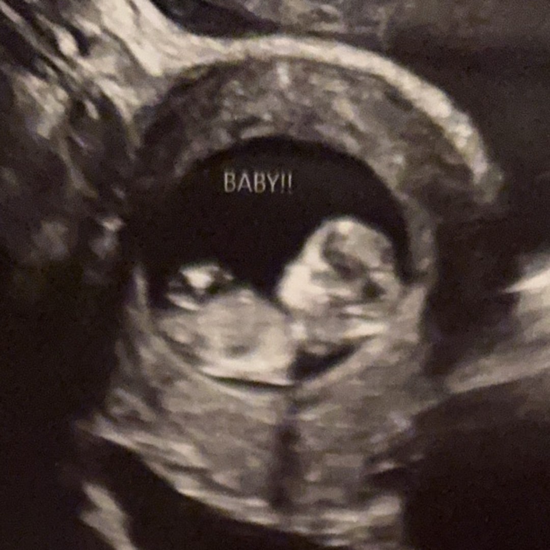 Photo shared by Mao for their Babylist baby registry.