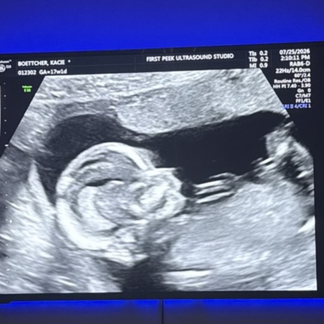 Photo shared by Kacie for their Babylist baby registry.