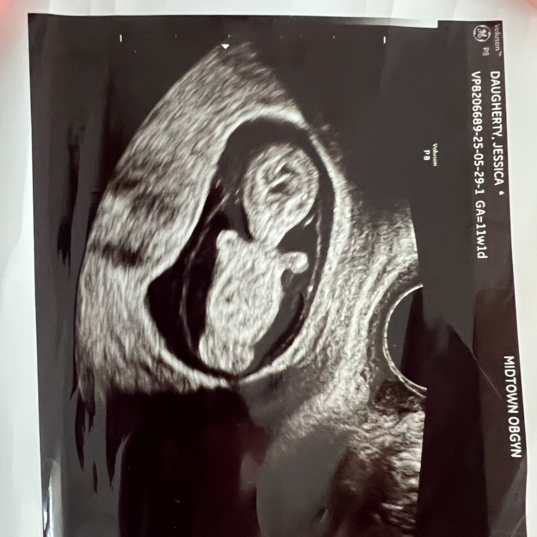 Photo shared by Laura for their Babylist baby registry.