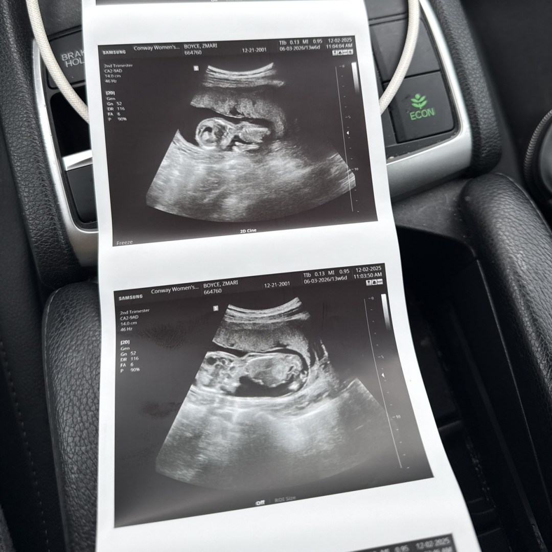 Photo shared by Z’mari for their Babylist baby registry.