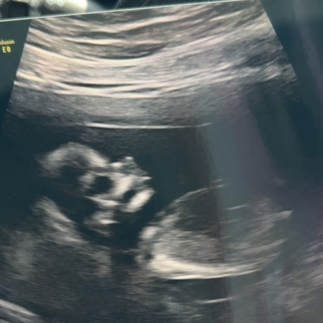 Photo shared by Kayla for their Babylist baby registry.