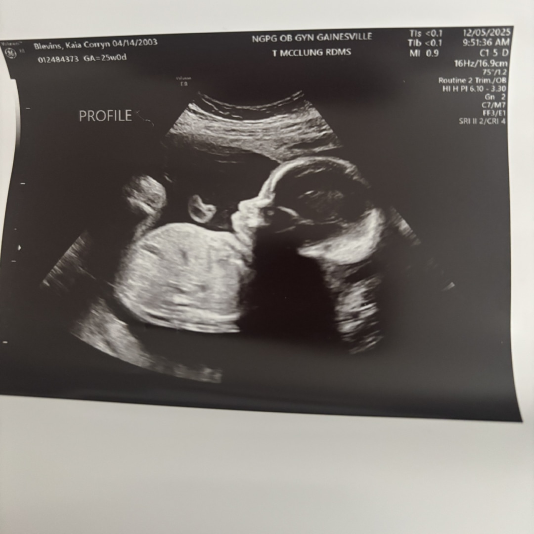 Photo shared by Kaia for their Babylist baby registry.