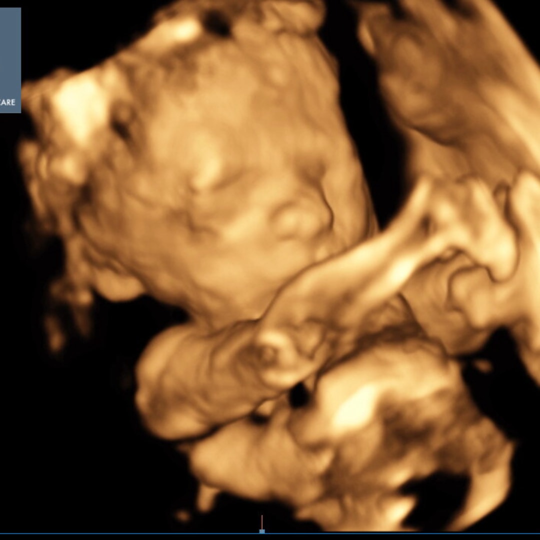 Photo shared by Kelly for their Babylist baby registry.