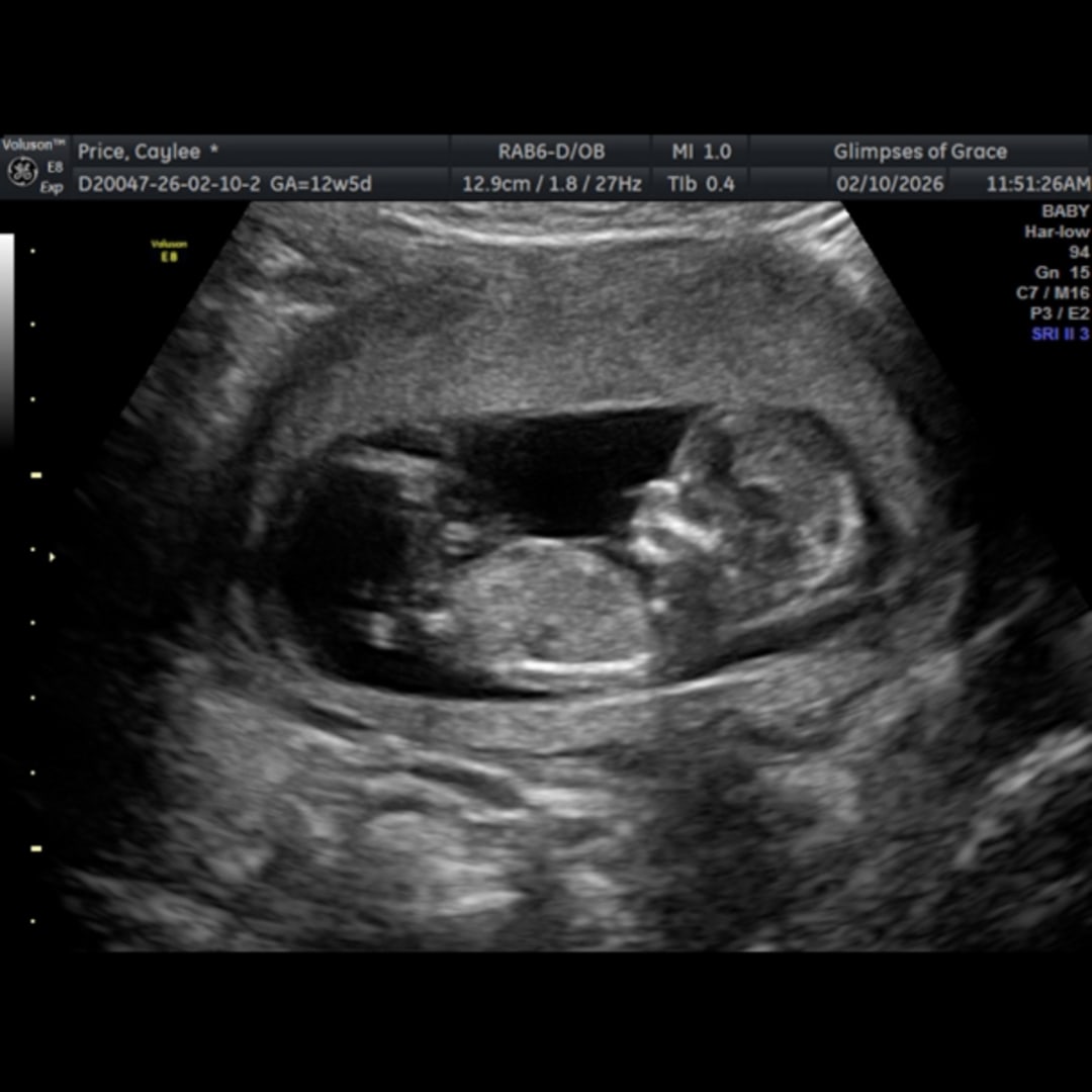 Photo shared by Caylee for their Babylist baby registry.