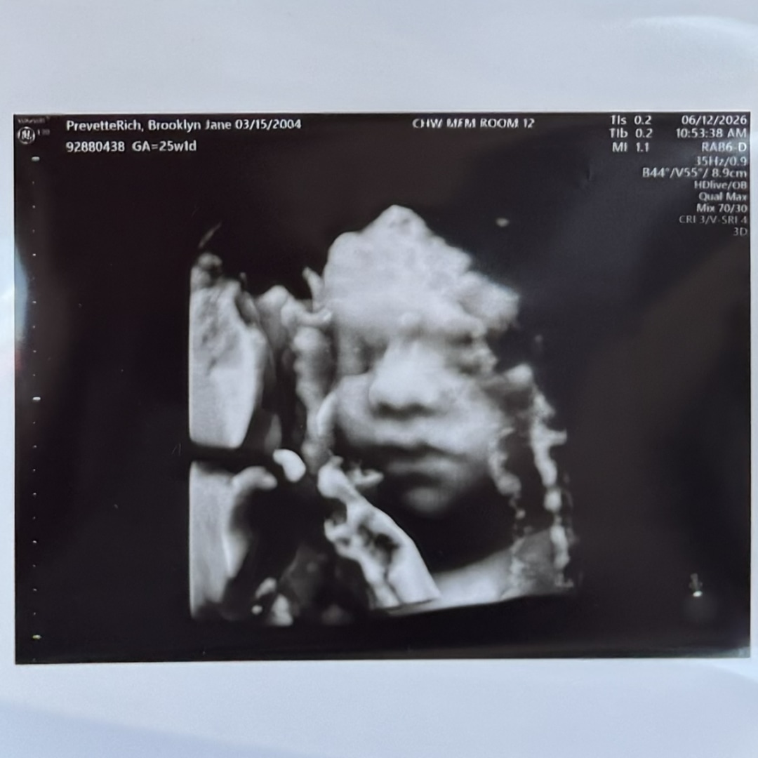 Photo shared by Brooklyn for their Babylist baby registry.