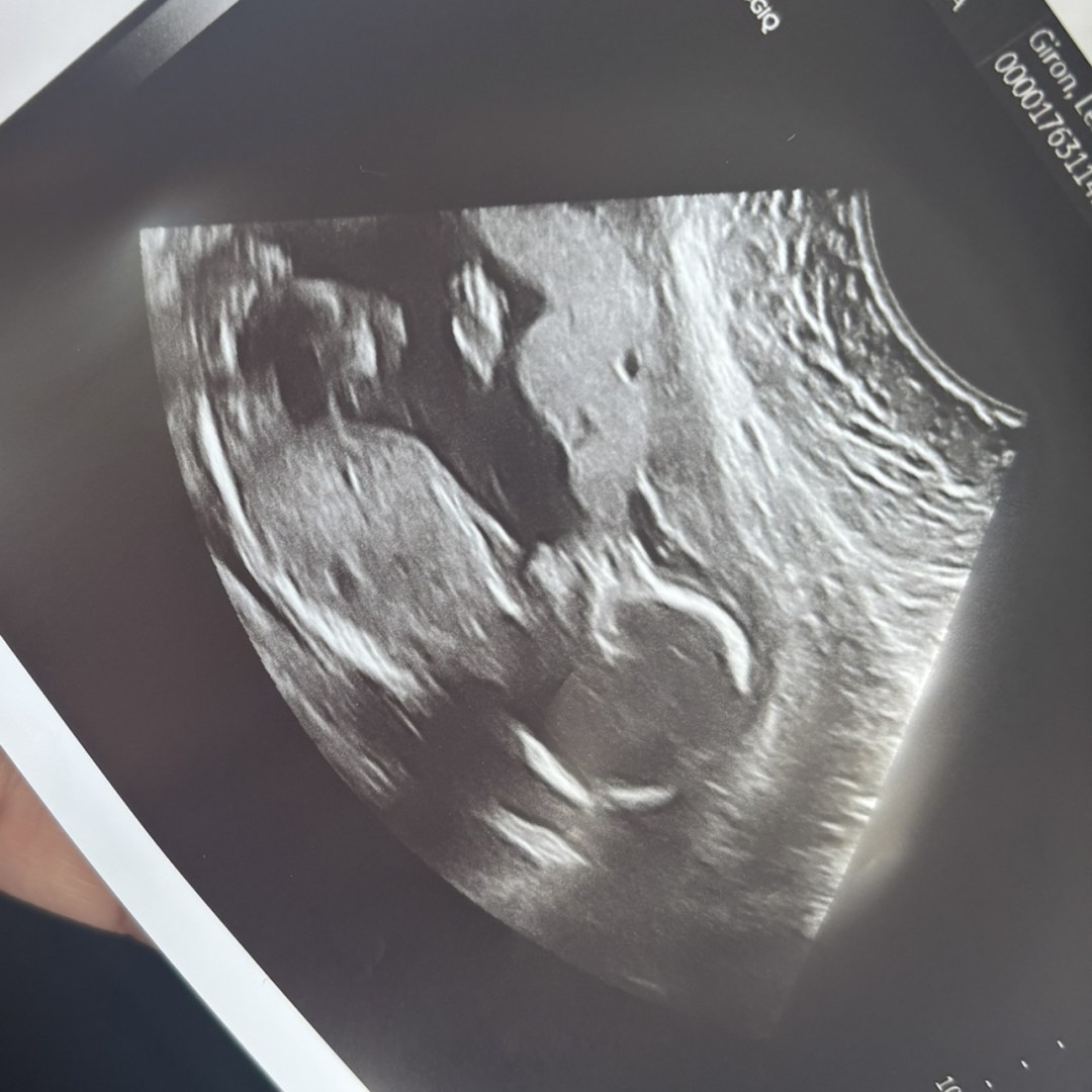 Photo shared by Leslie for their Babylist baby registry.