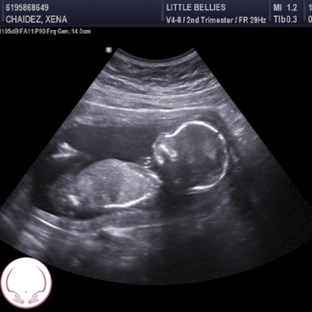 Photo shared by Xena for their Babylist baby registry.