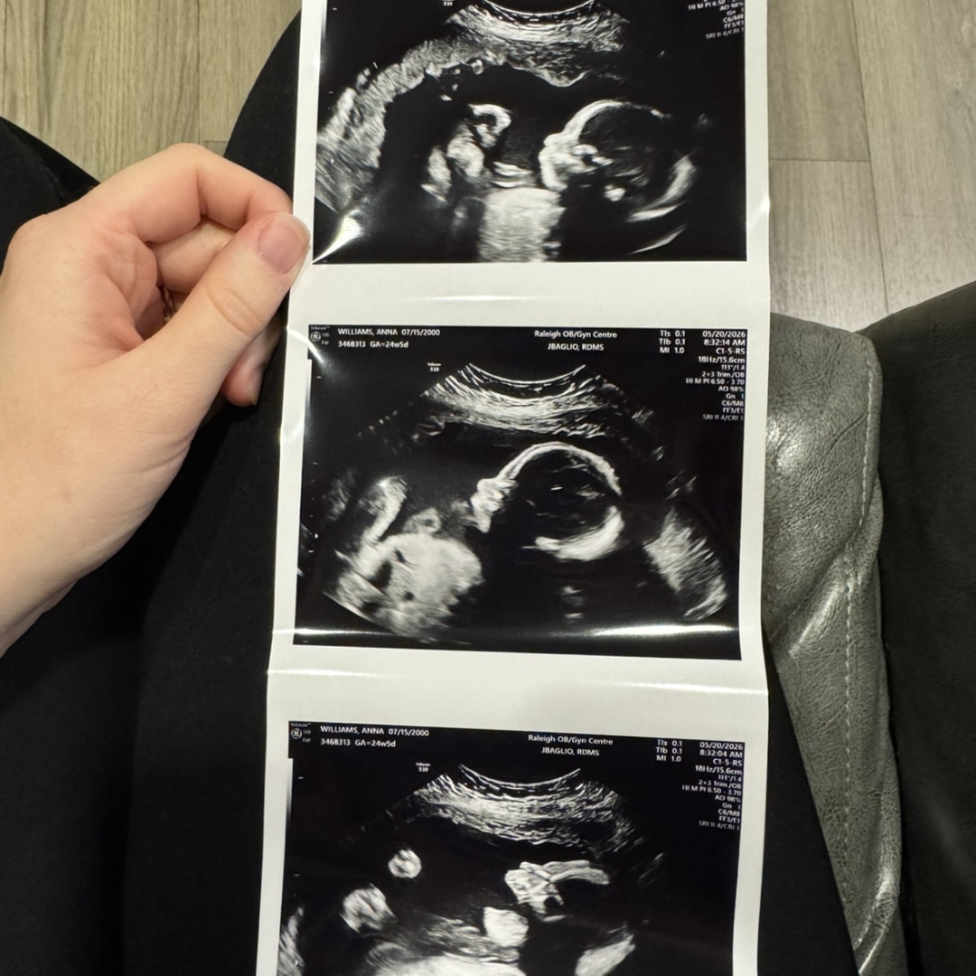 Photo shared by Anna for their Babylist baby registry.
