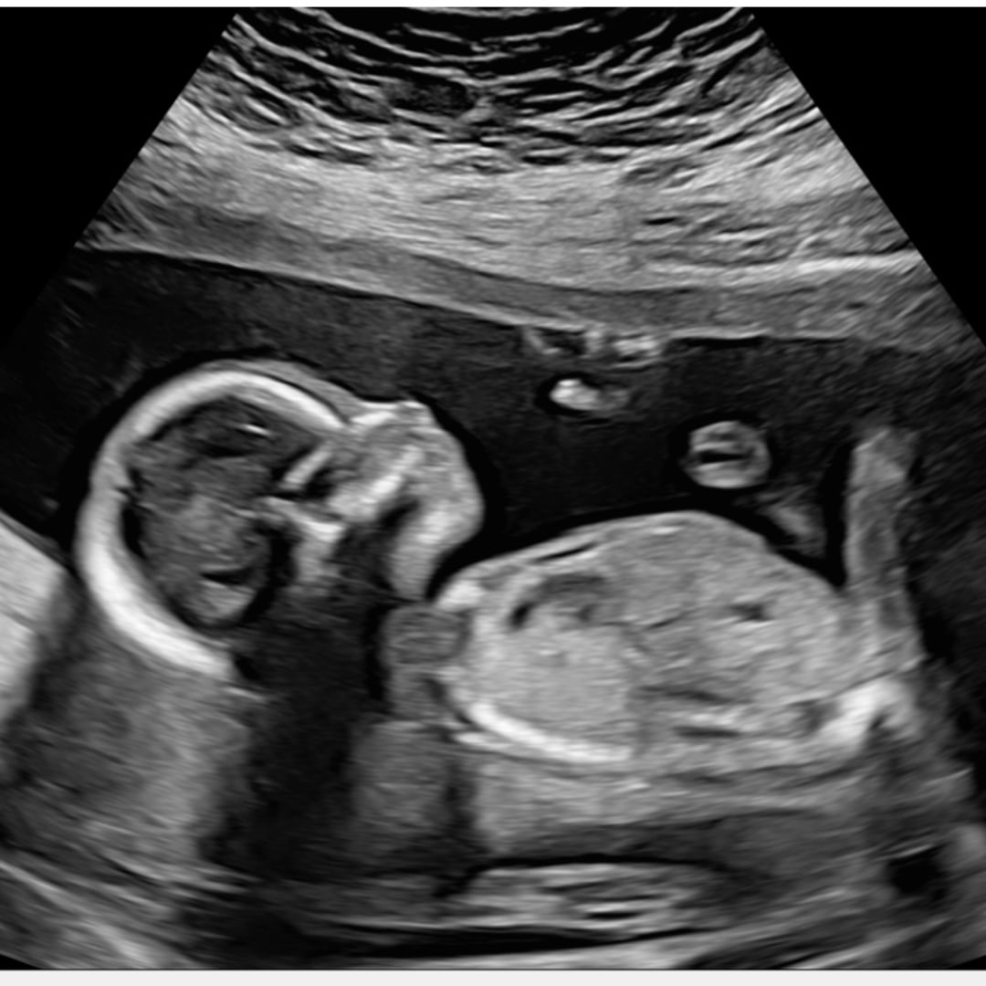 Photo shared by Amy for their Babylist baby registry.