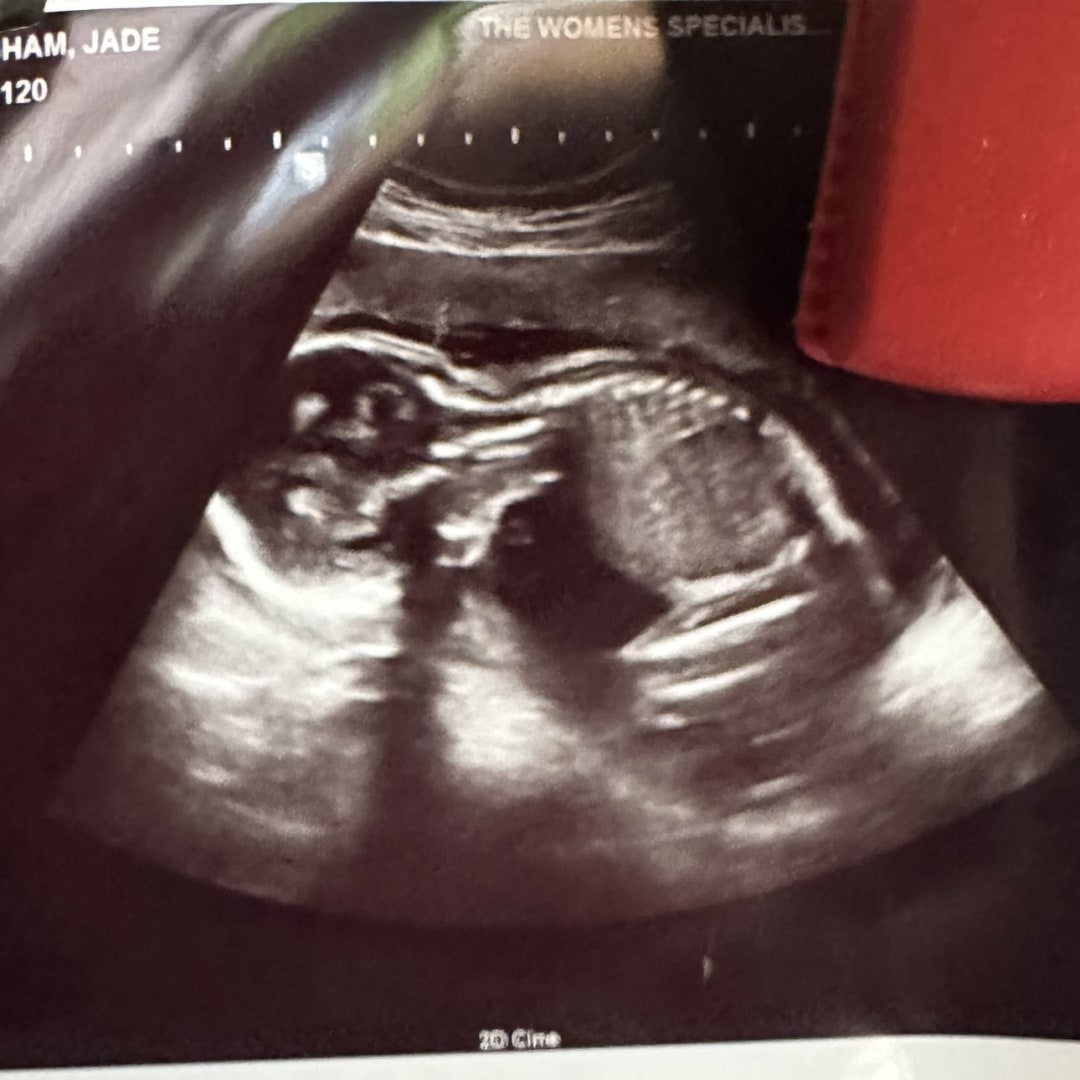 Photo shared by Jade for their Babylist baby registry.