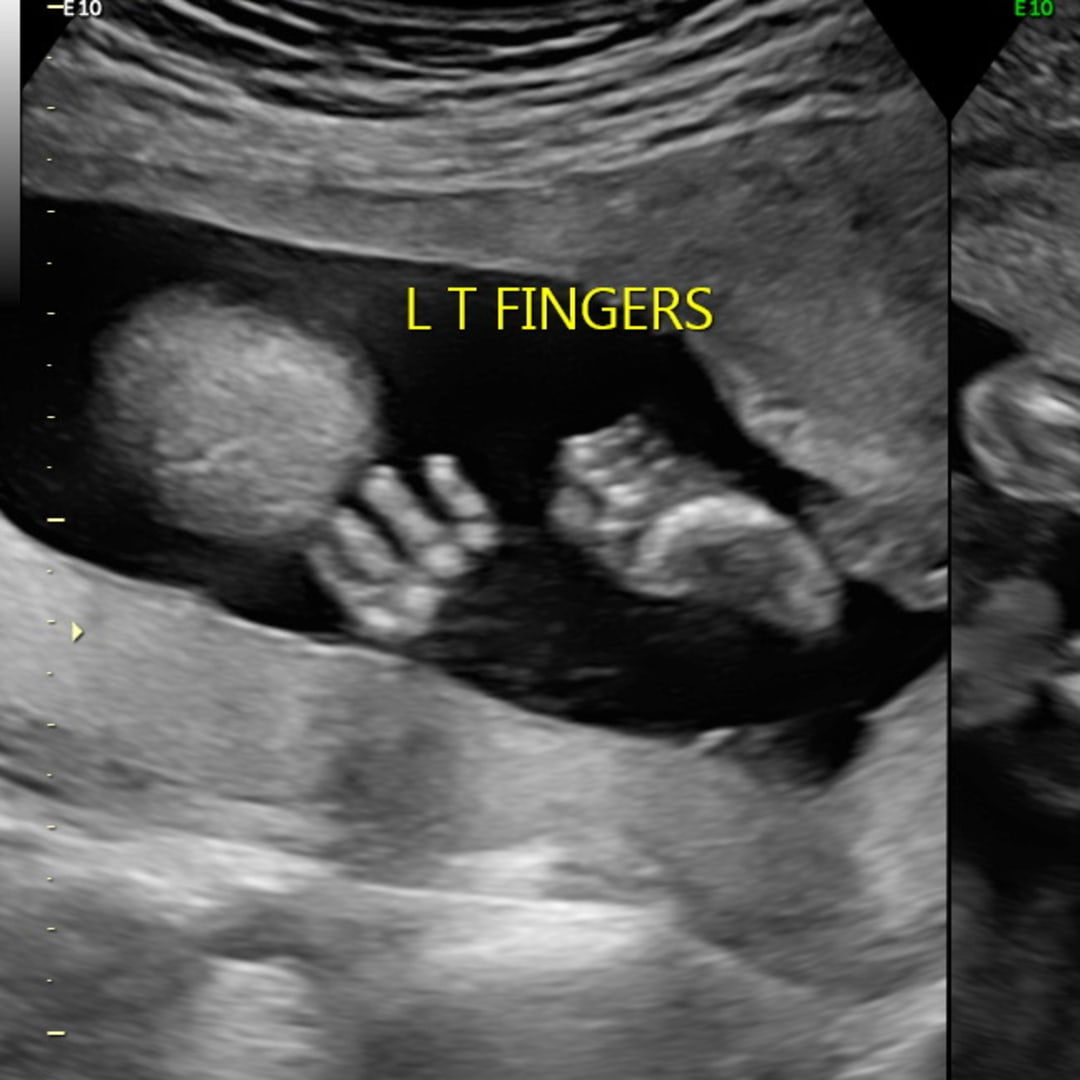 Photo shared by Horiana for their Babylist baby registry.