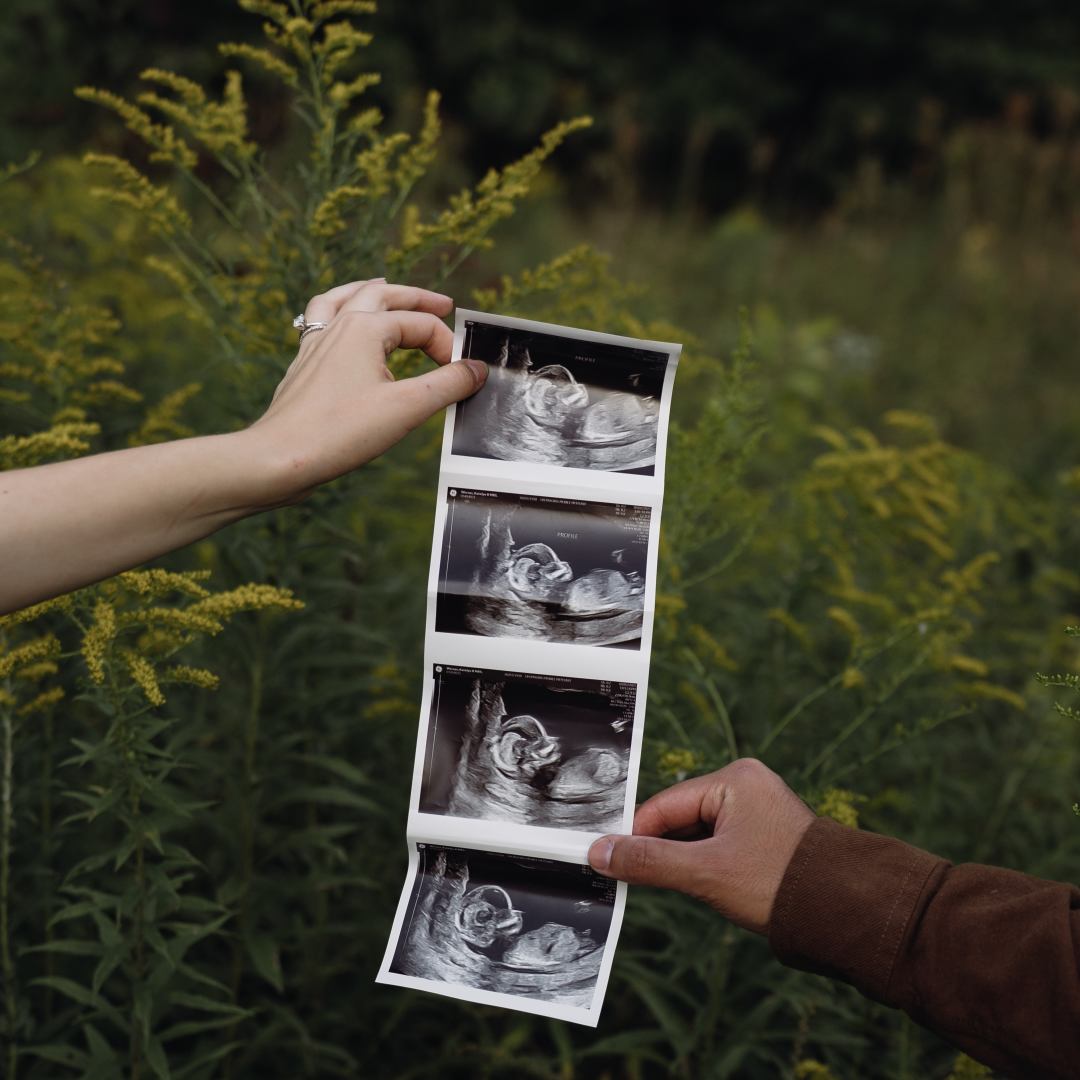 Photo shared by Katelyn for their Babylist baby registry.