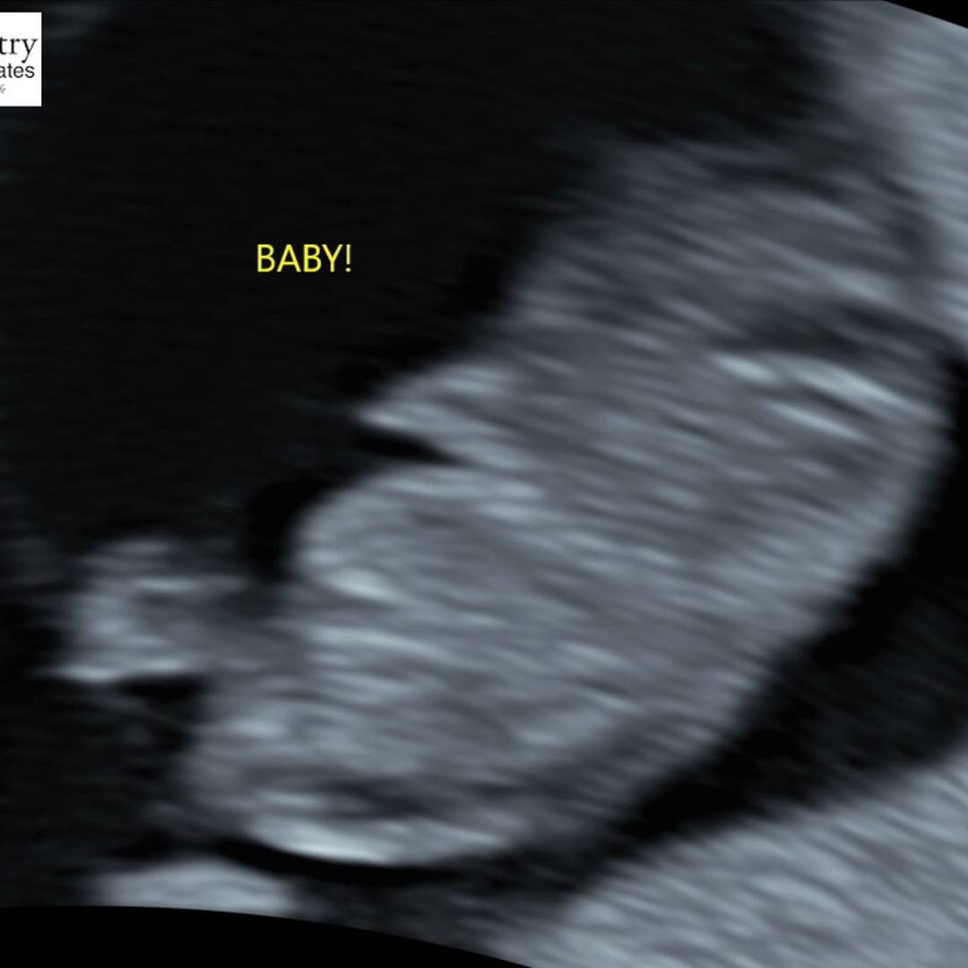 Photo shared by Sandy for their Babylist baby registry.