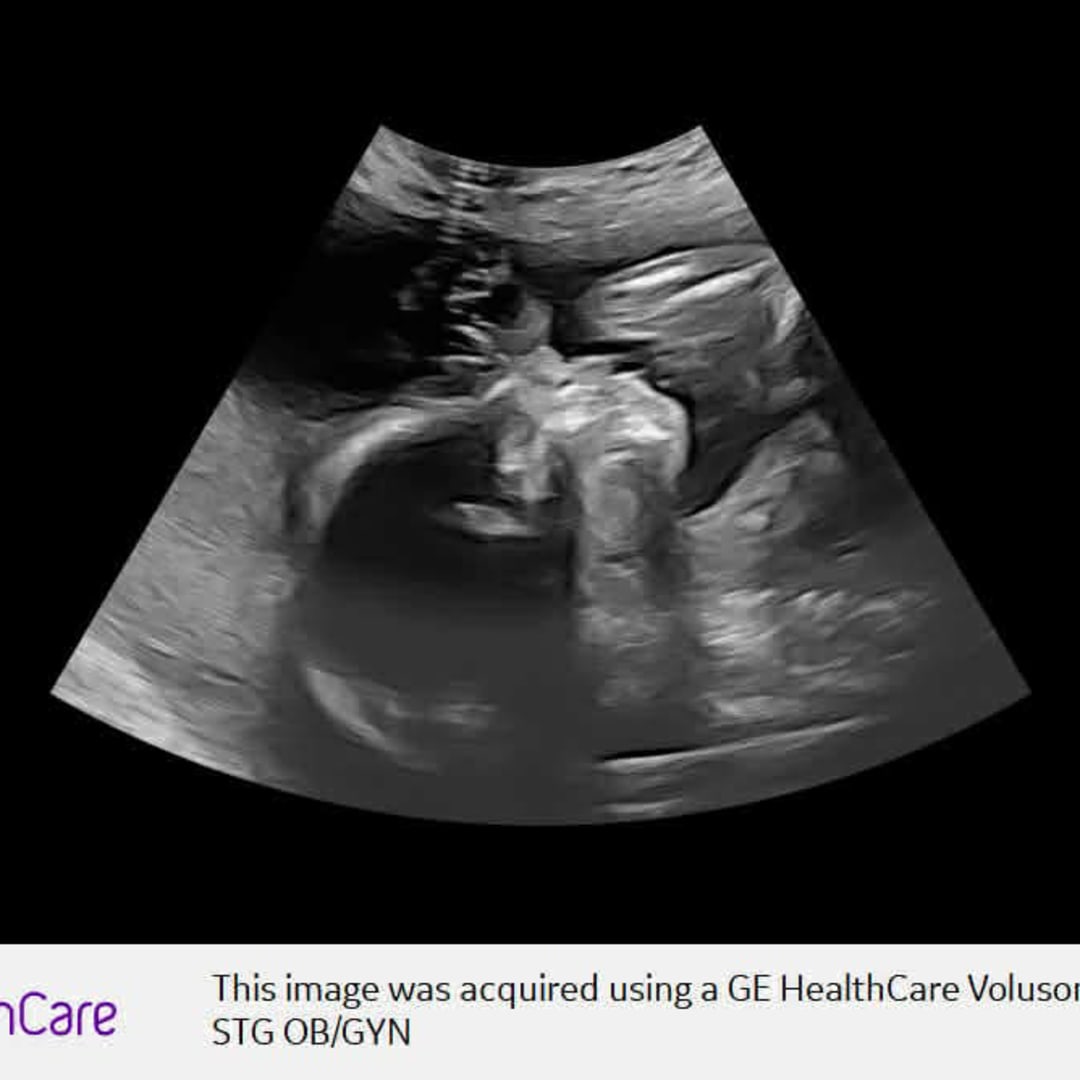 Photo shared by Elena for their Babylist baby registry.