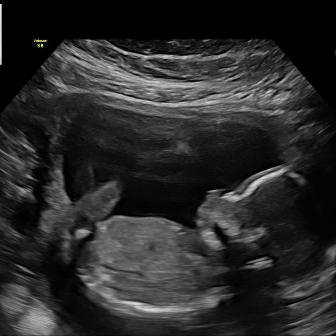 Photo shared by Alayna for their Babylist baby registry.