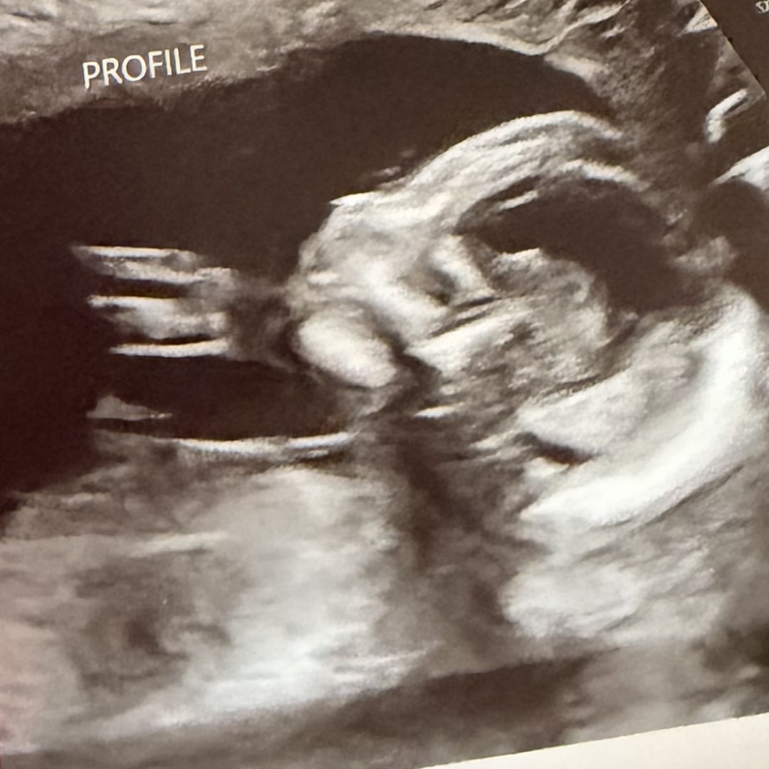 Photo shared by Luz Carolina for their Babylist baby registry.