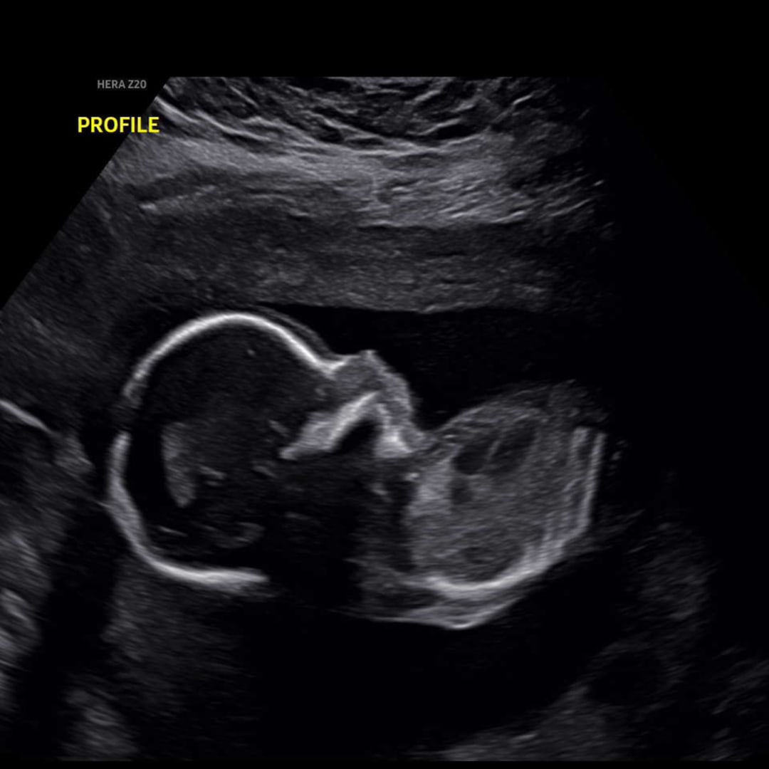 Photo shared by Belle for their Babylist baby registry.