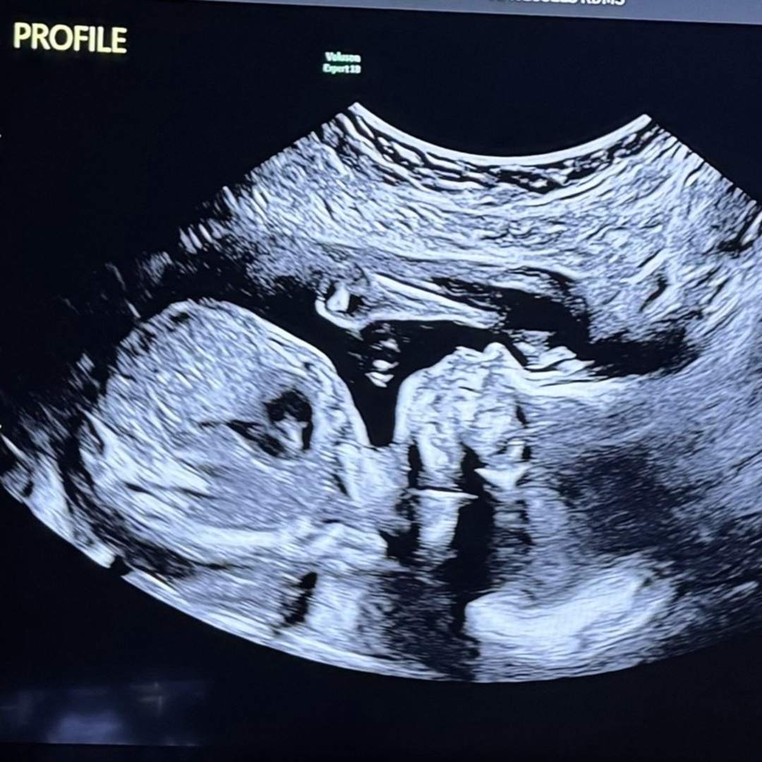 Photo shared by Ellie for their Babylist baby registry.
