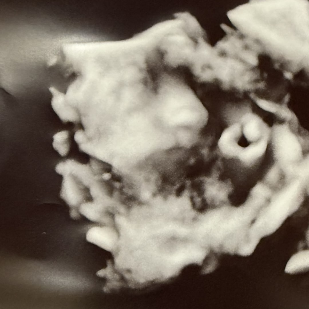 Photo shared by Christianna for their Babylist baby registry.