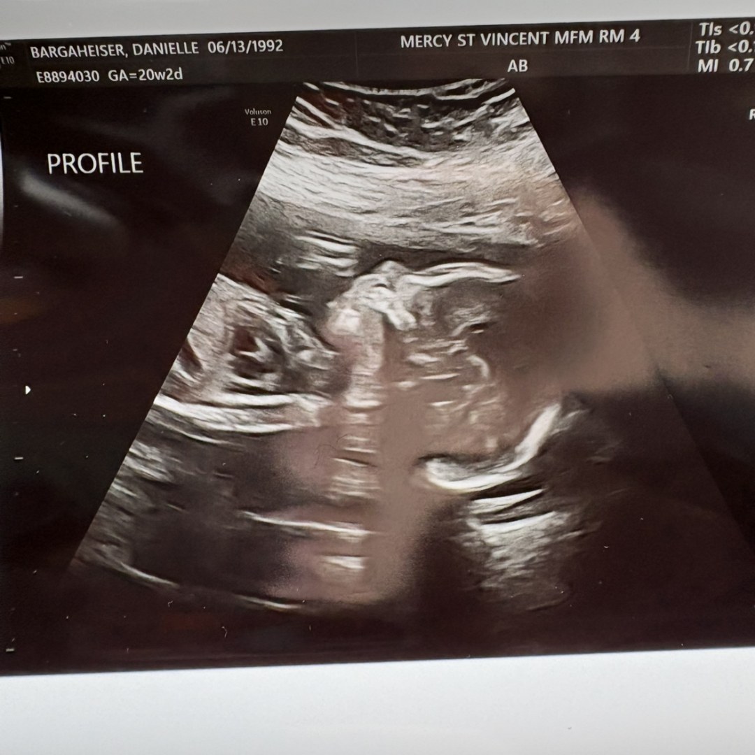 Photo shared by Danielle for their Babylist baby registry.