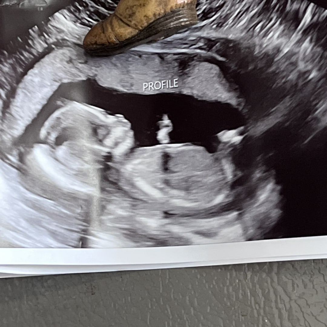 Photo shared by Bentley for their Babylist baby registry.