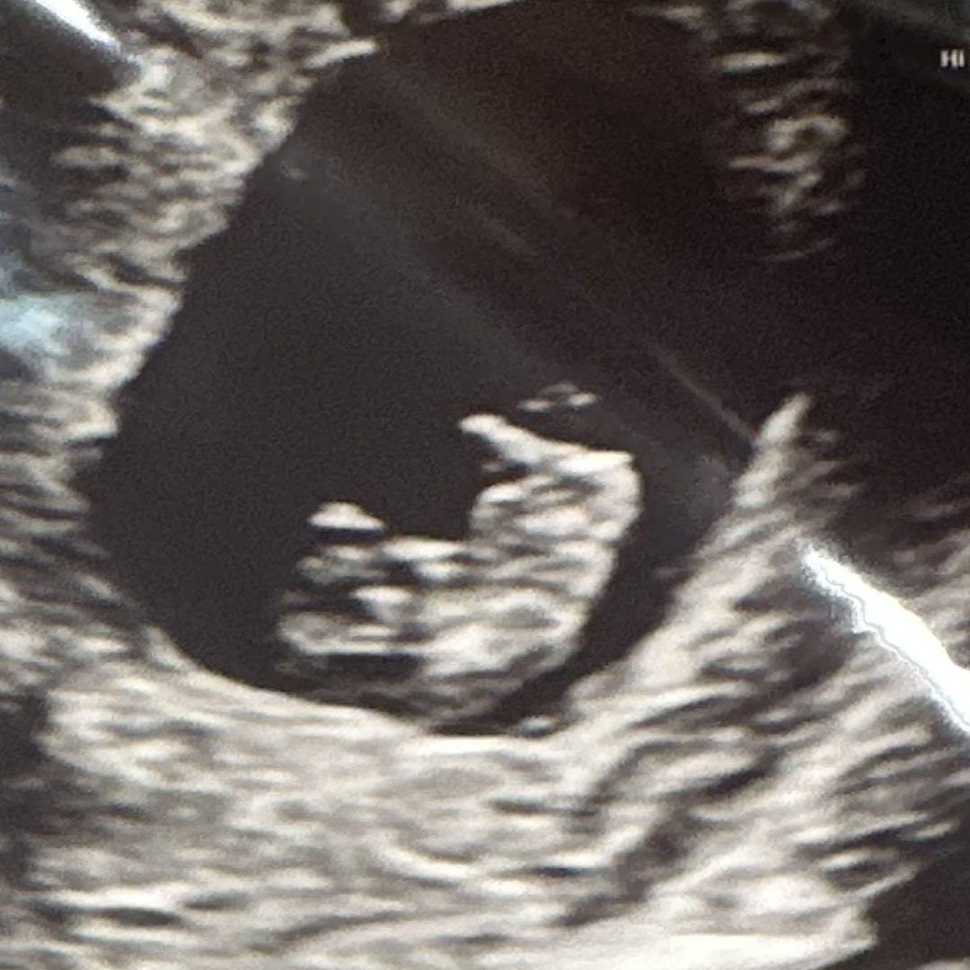Photo shared by Allyse for their Babylist baby registry.