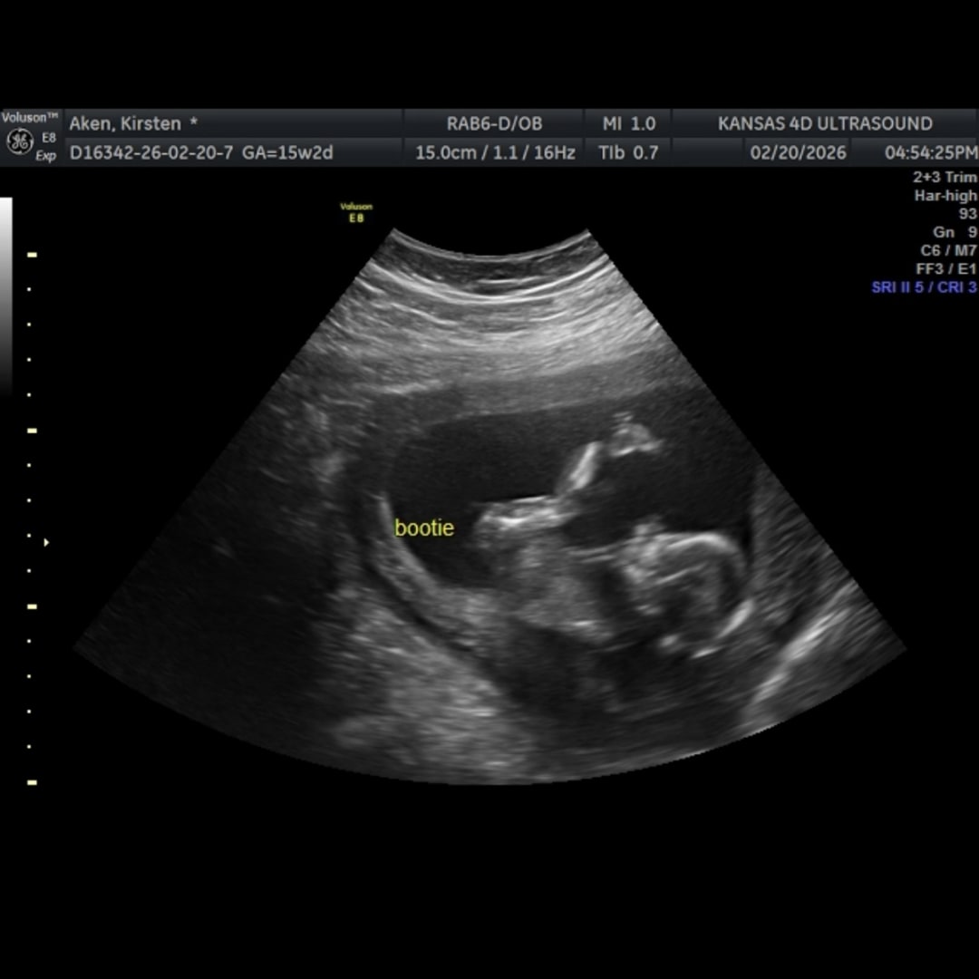 Photo shared by Kirsten for their Babylist baby registry.