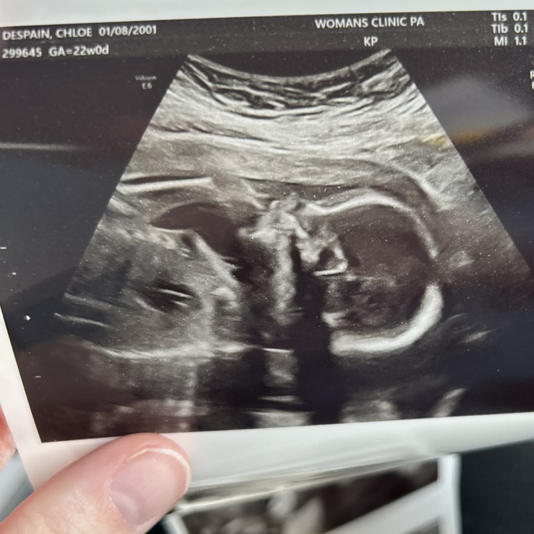 Photo shared by Chloe for their Babylist baby registry.