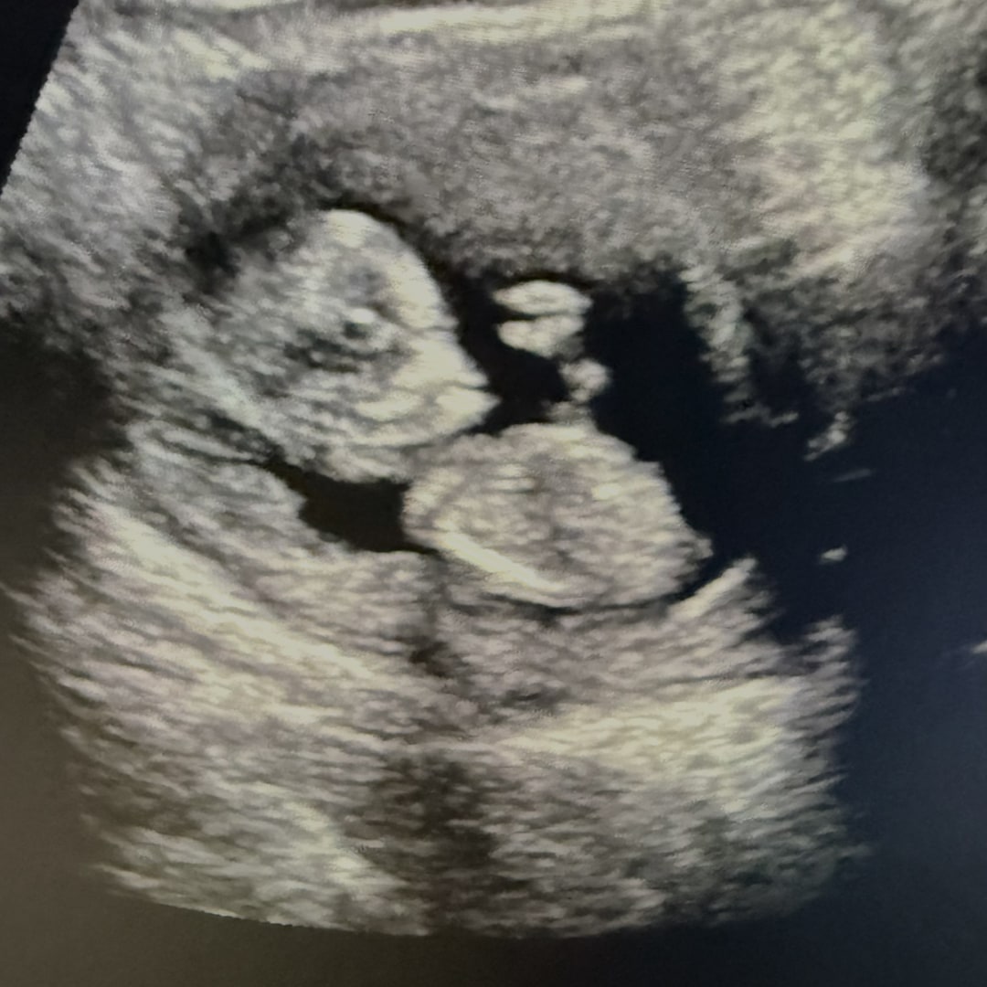 Photo shared by Nathalie for their Babylist baby registry.