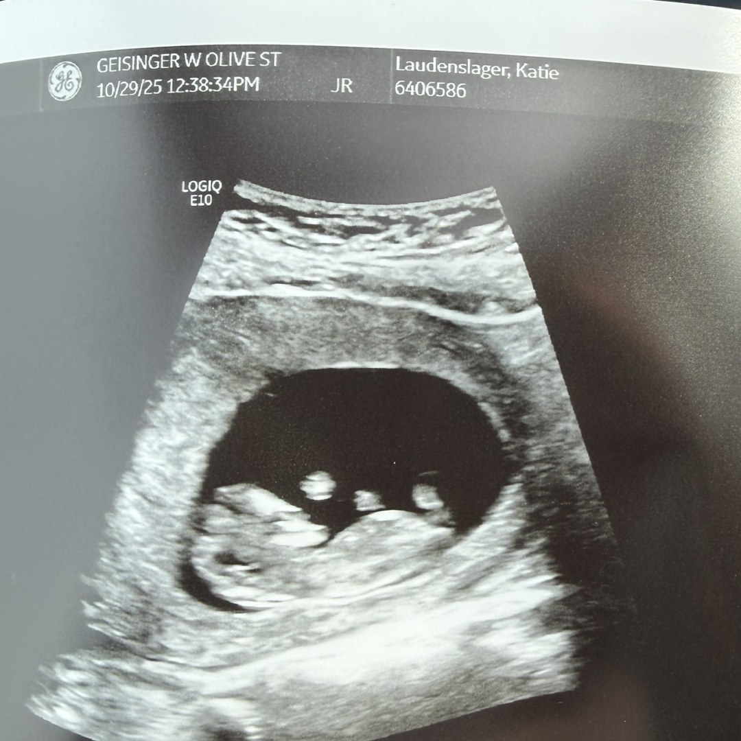 Photo shared by Katie for their Babylist baby registry.