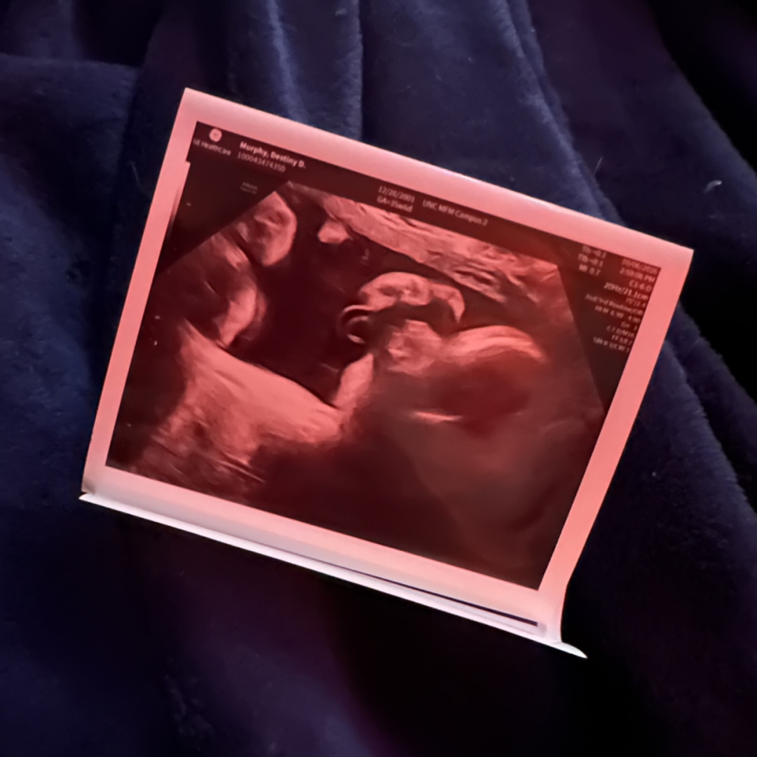 Photo shared by Kaze for their Babylist baby registry.