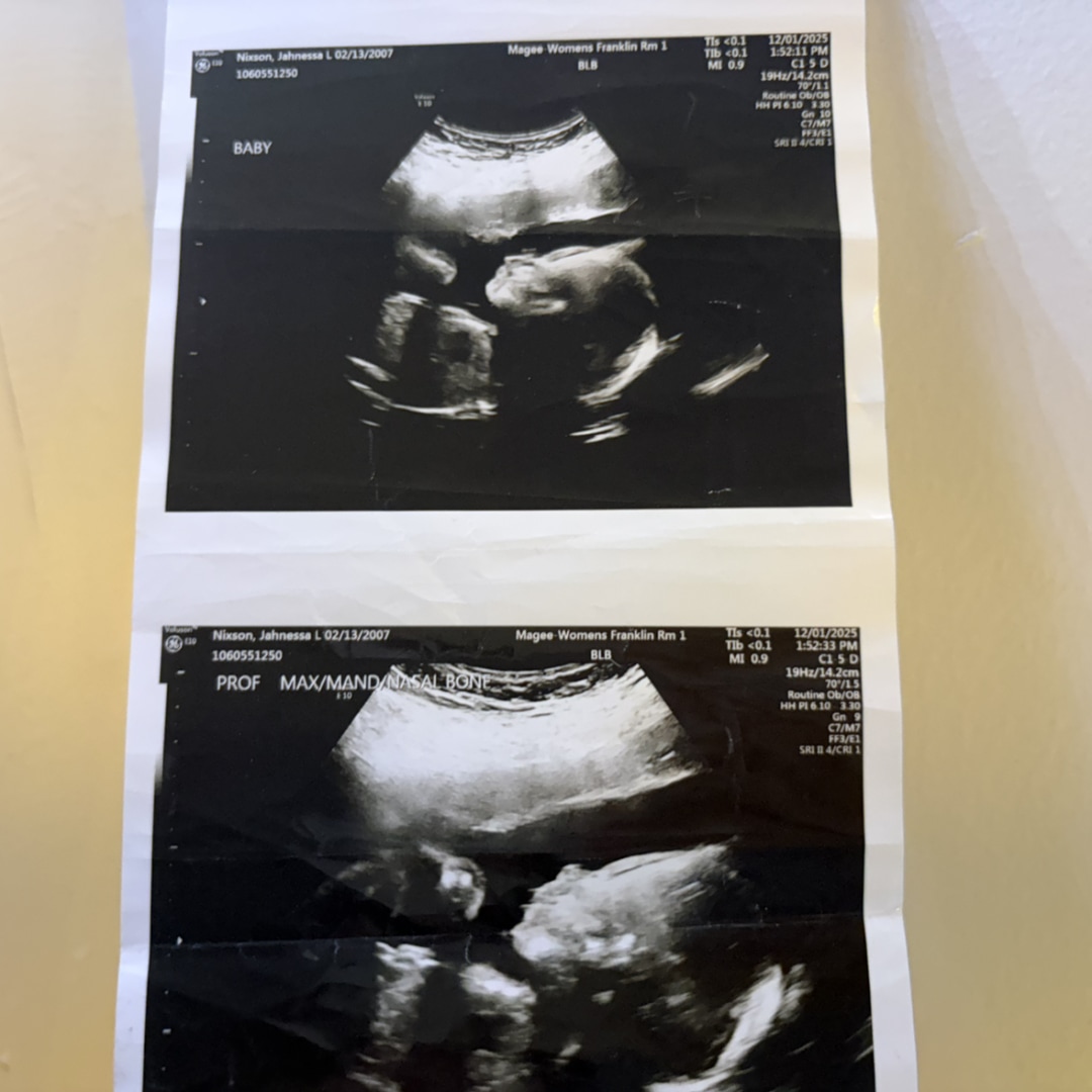 Photo shared by Jahneesa for their Babylist baby registry.