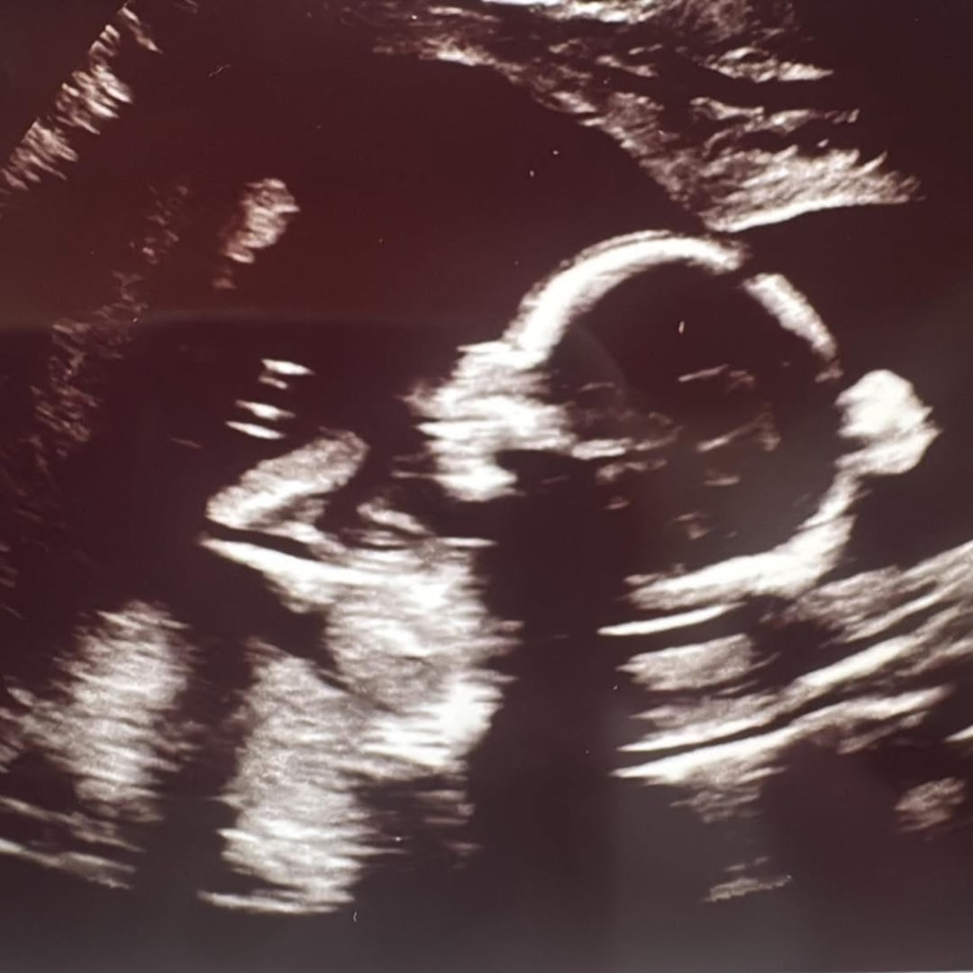 Photo shared by Coco for their Babylist baby registry.