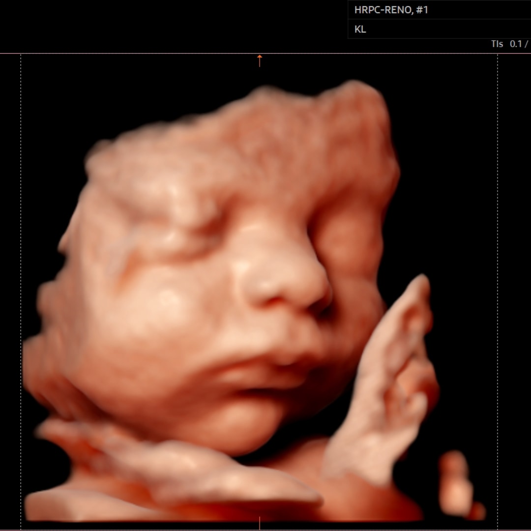 Photo shared by Hannah for their Babylist baby registry.