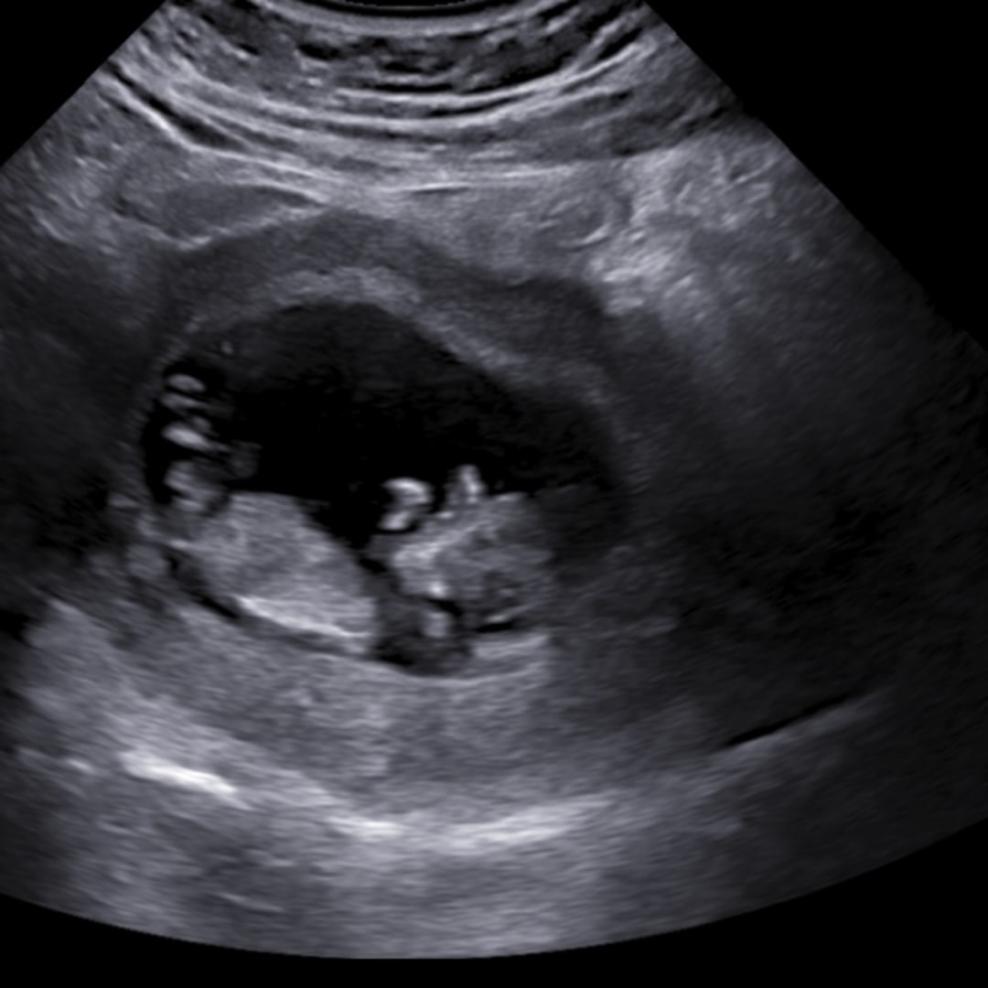 Photo shared by Baylee for their Babylist baby registry.