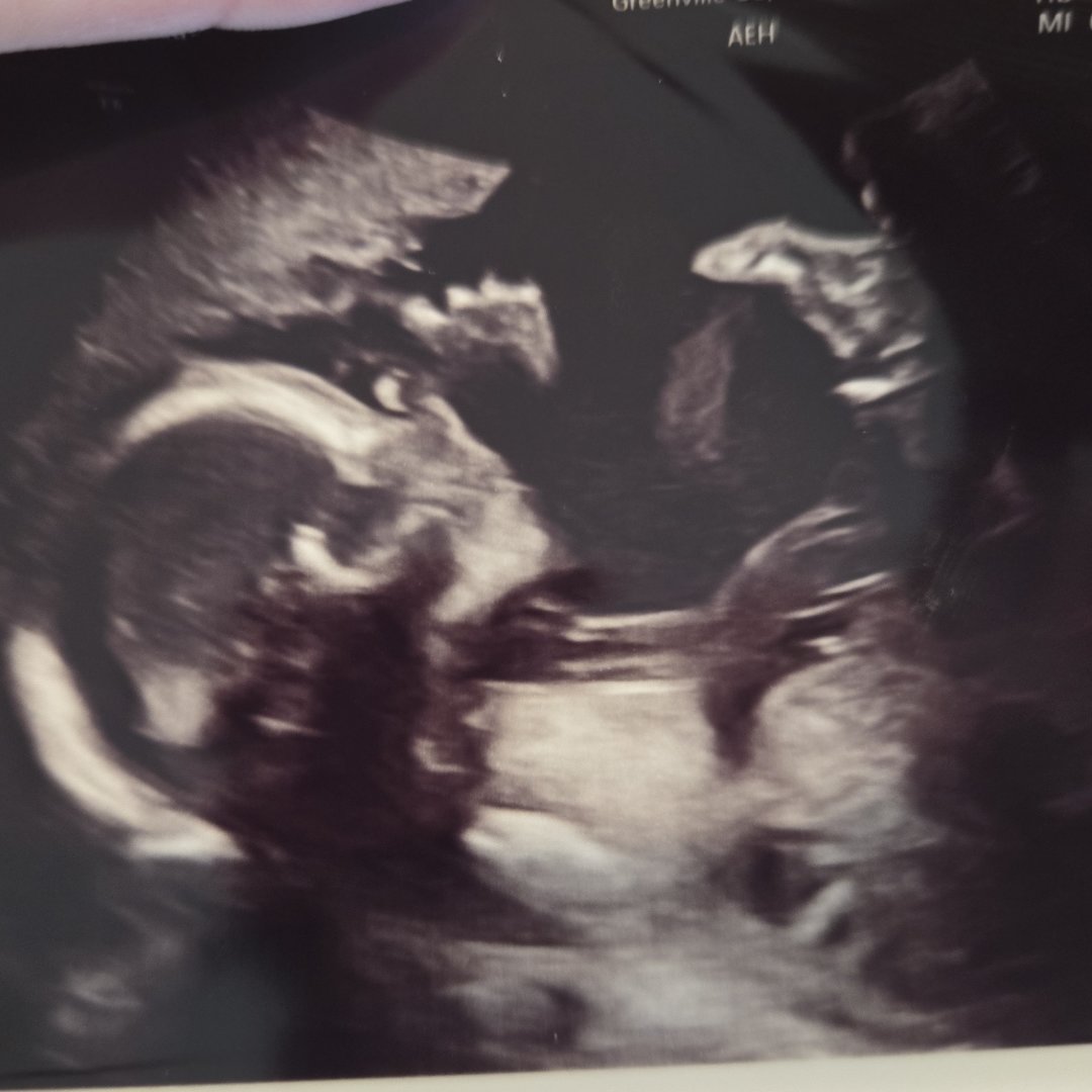 Photo shared by Jayden for their Babylist baby registry.