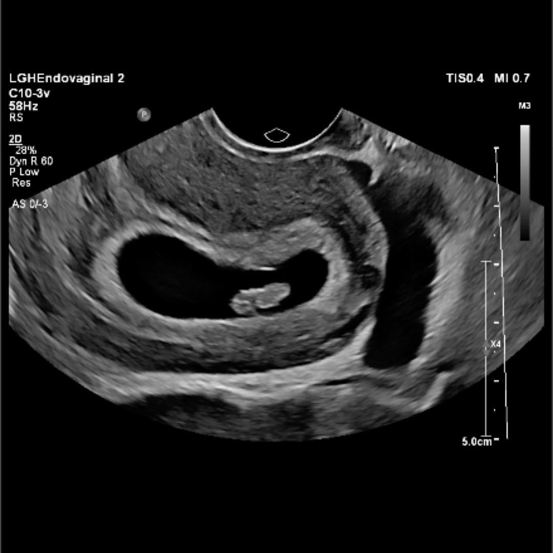 Photo shared by Ileyshka for their Babylist baby registry.