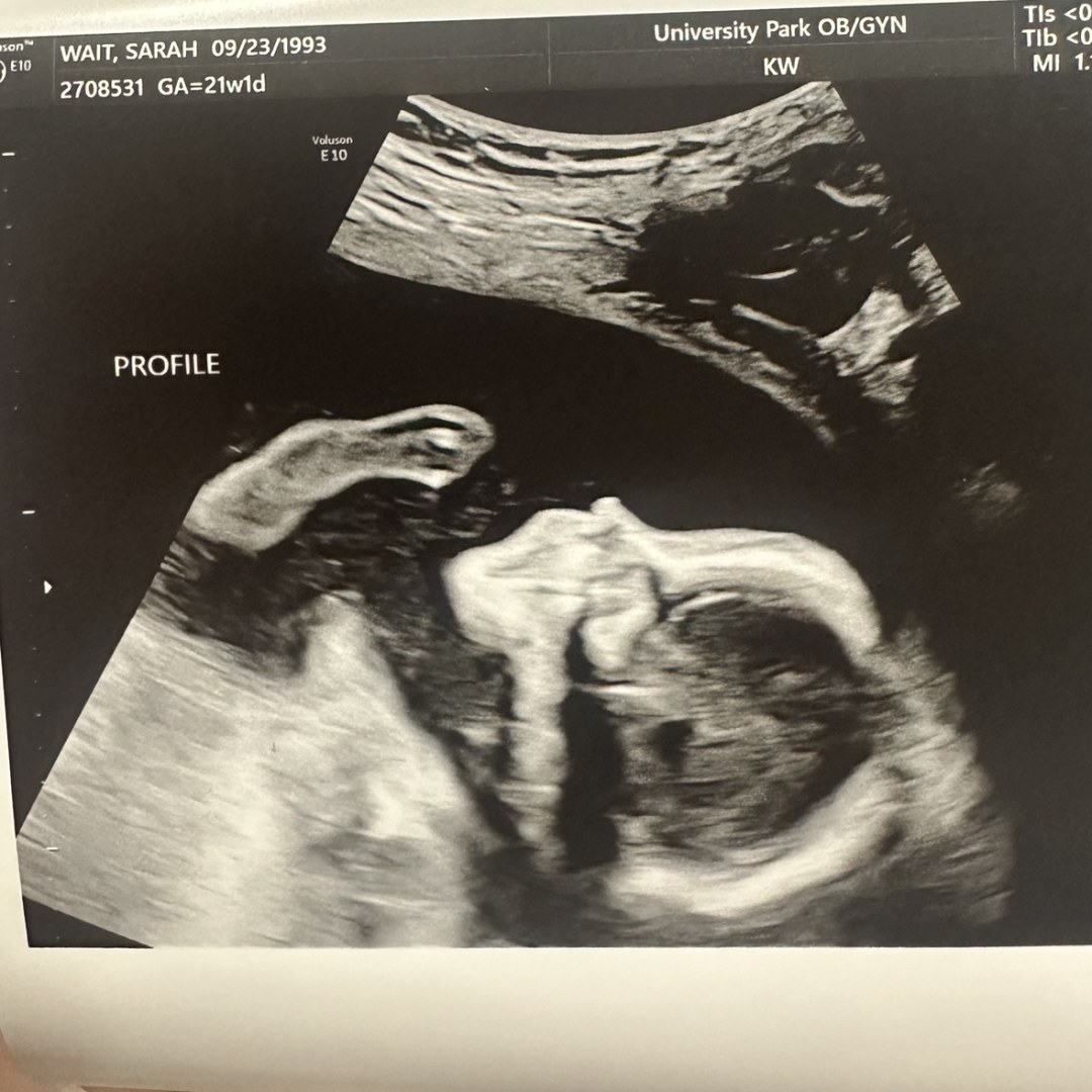 Photo shared by Sarah for their Babylist baby registry.