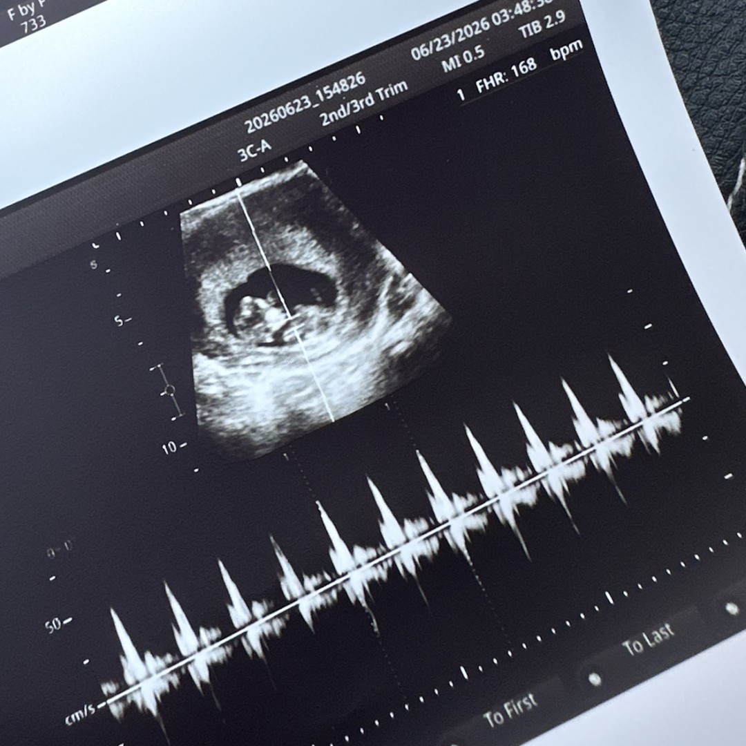 Photo shared by Kaitlyn for their Babylist baby registry.