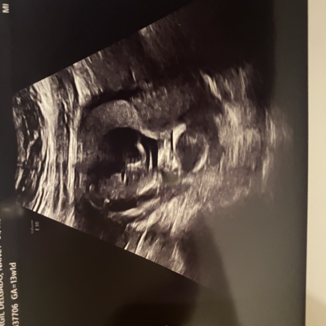 Photo shared by Nancy for their Babylist baby registry.