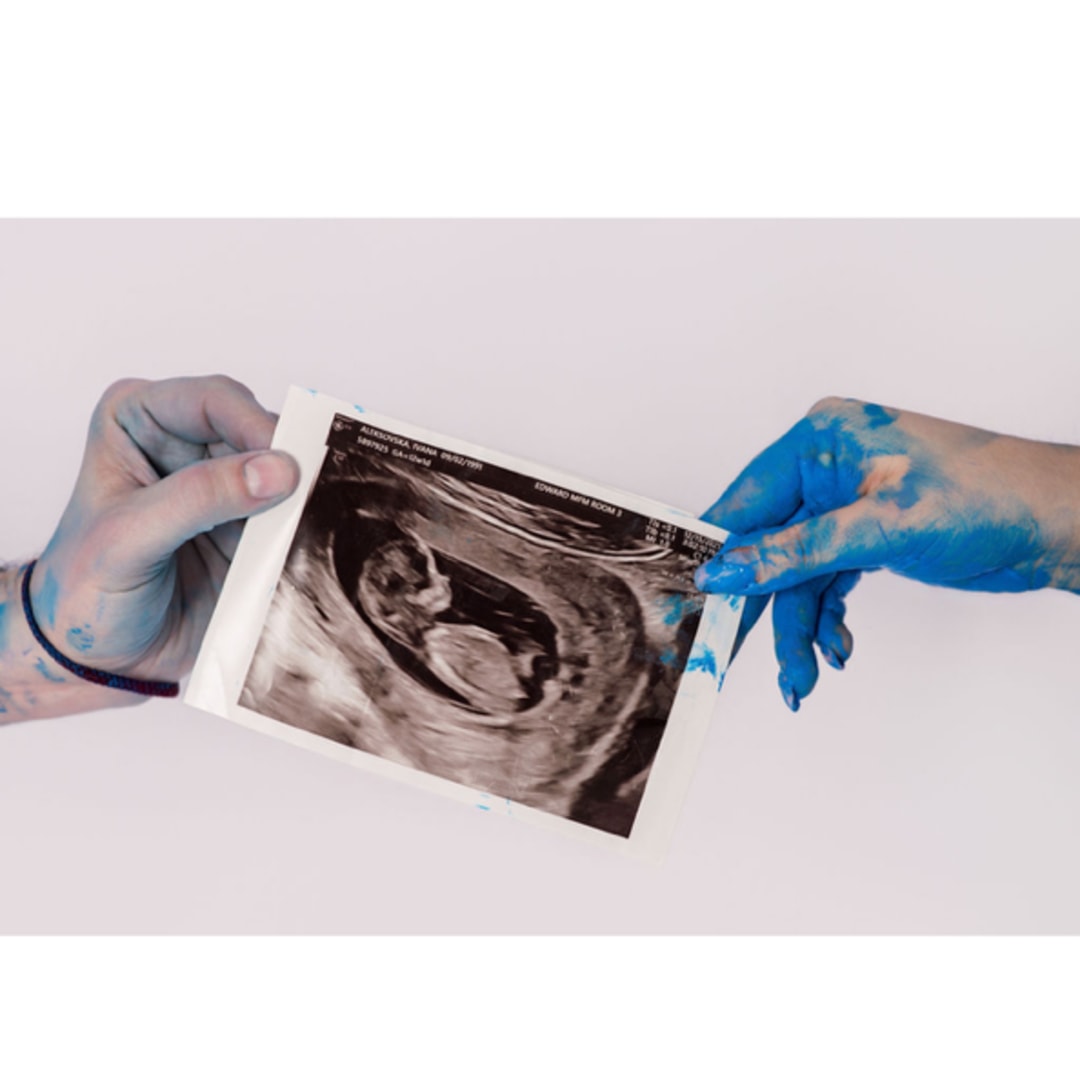 Photo shared by Ivana for their Babylist baby registry.