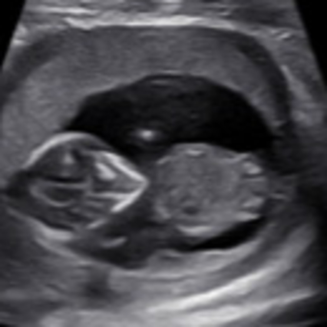 Photo shared by Alexis for their Babylist baby registry.