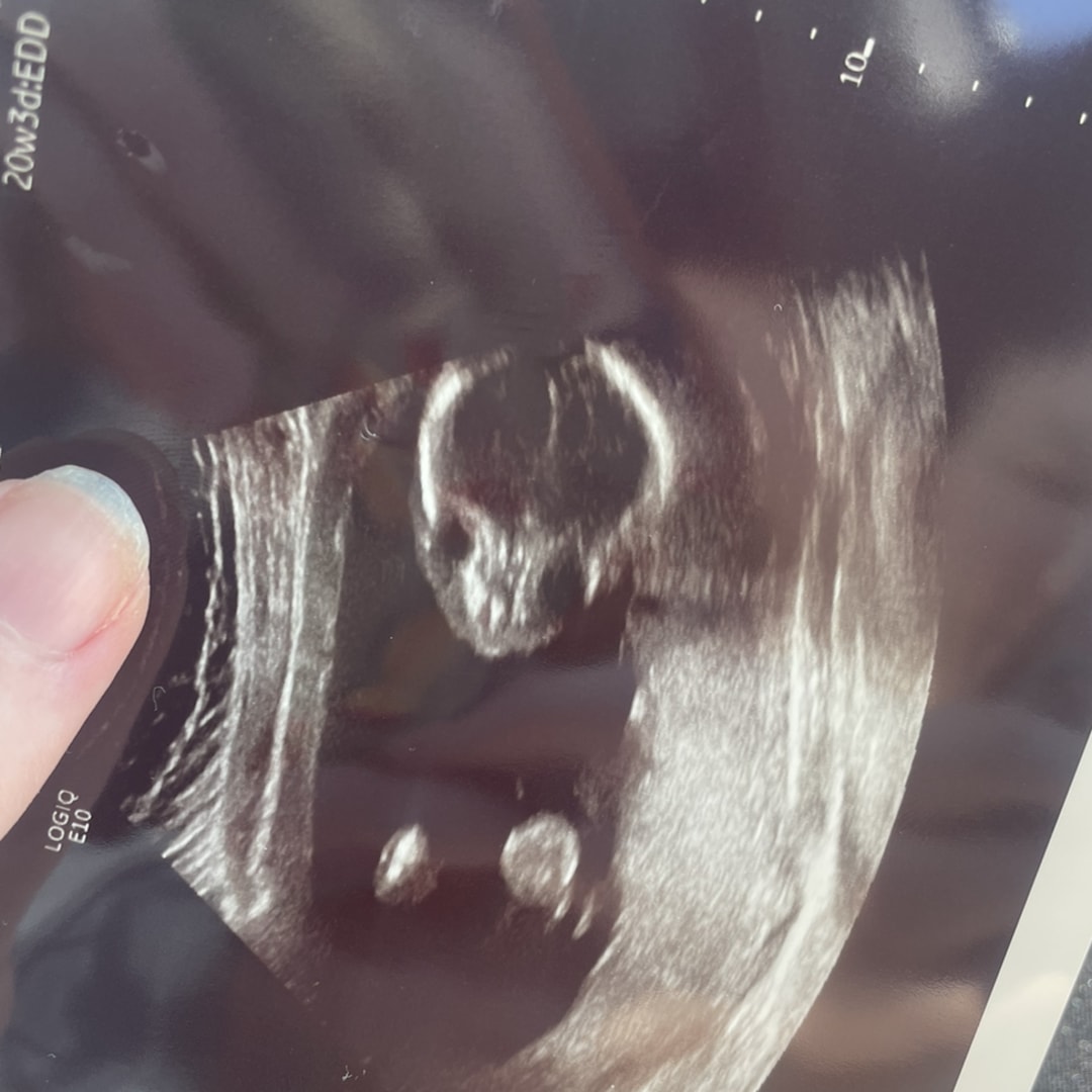 Photo shared by Alexis for their Babylist baby registry.