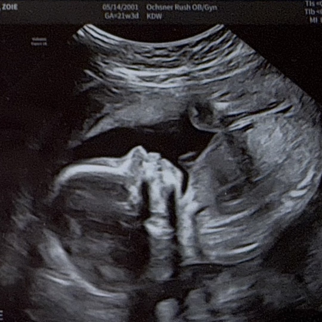 Photo shared by Zoie for their Babylist baby registry.