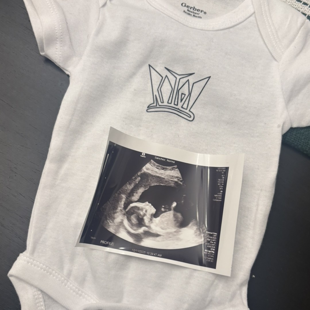 Photo shared by Norma for their Babylist baby registry.