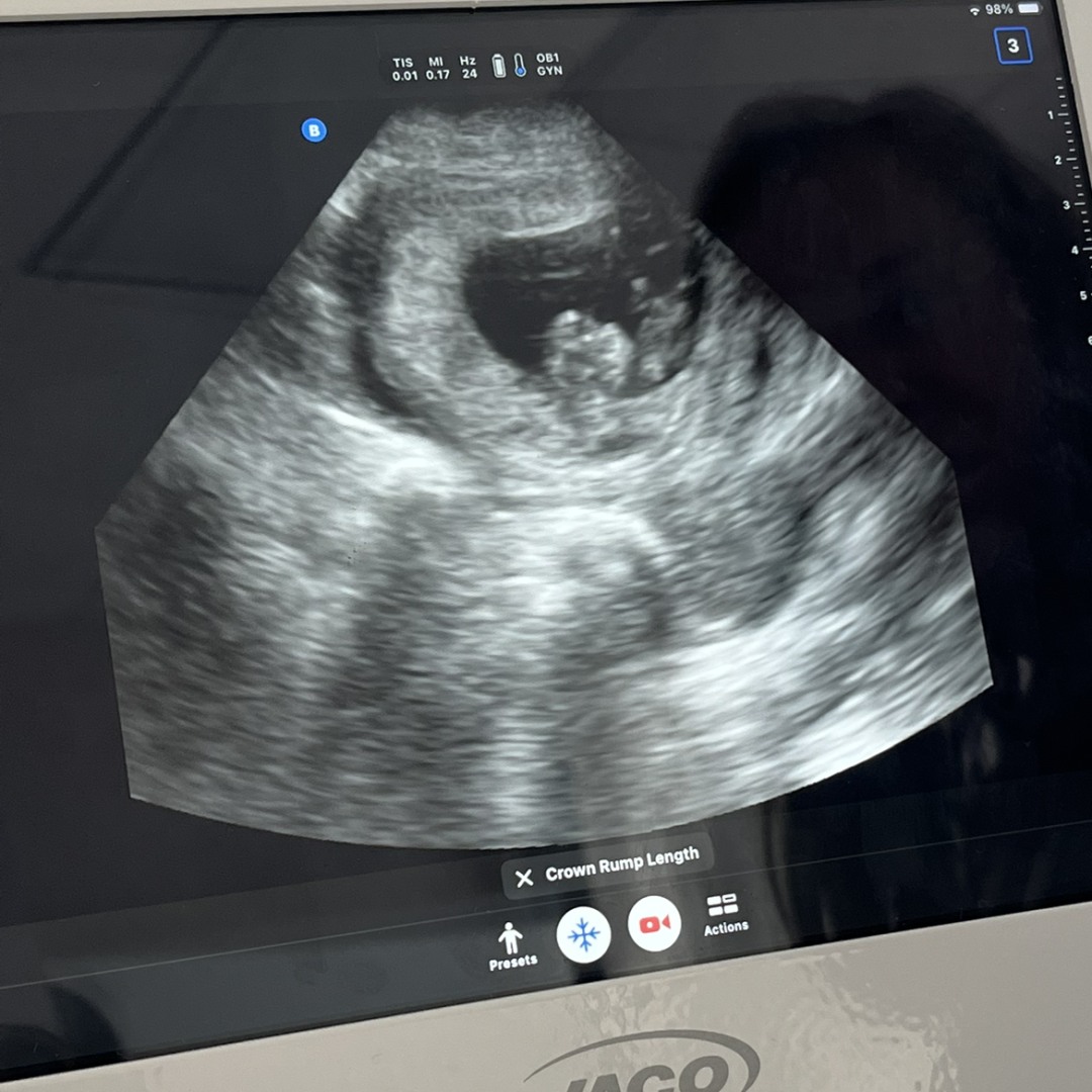 Photo shared by Megan for their Babylist baby registry.