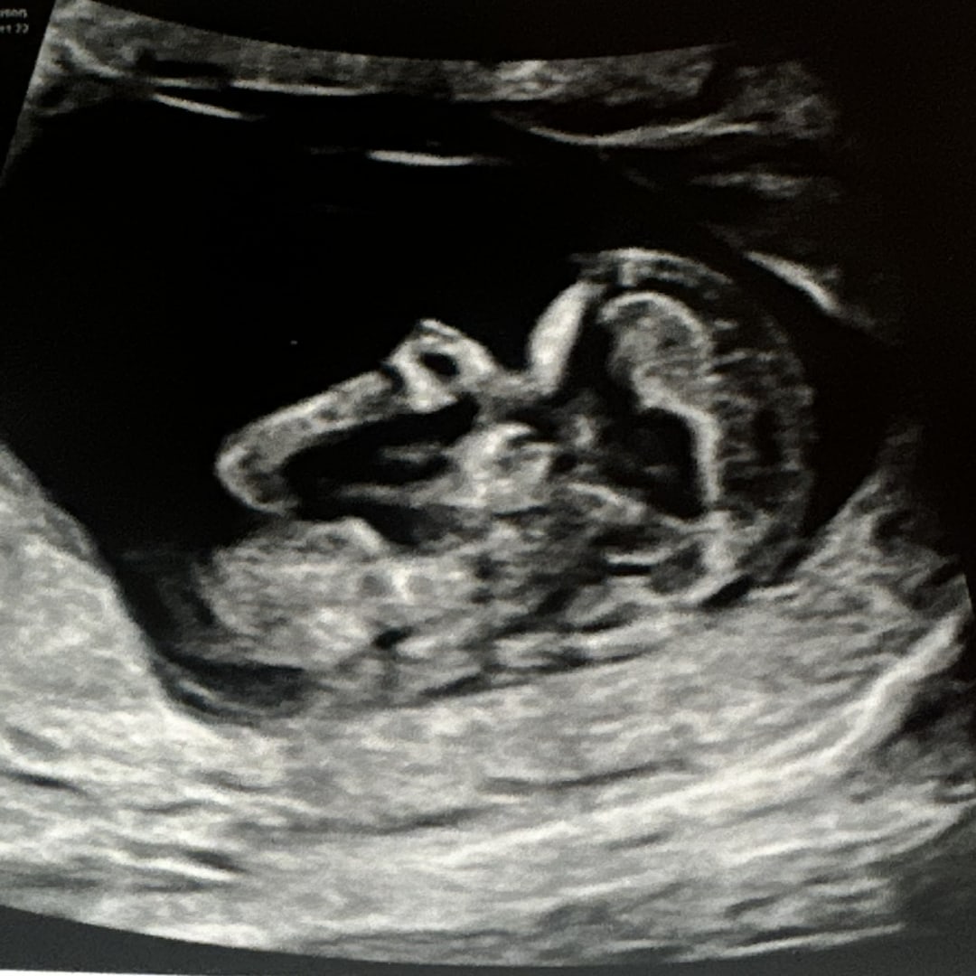 Photo shared by Ty for their Babylist baby registry.